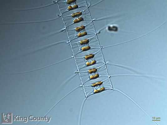 Photo of Chaetoceros vanheurckii